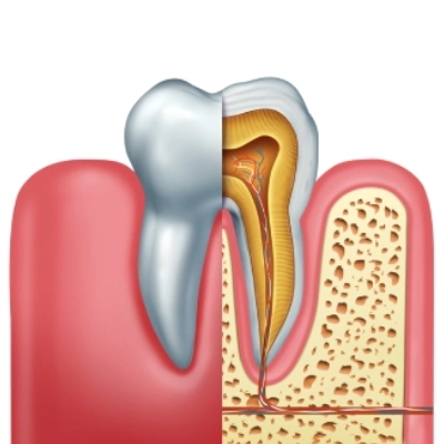 benefits of root canal